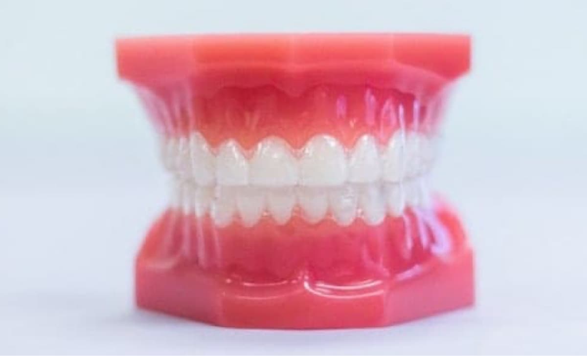 invisalign aligners on model