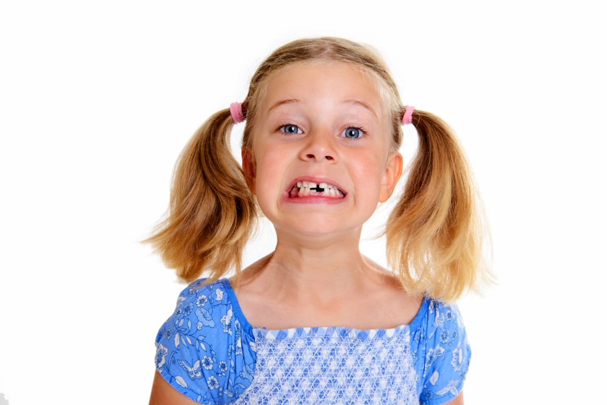 Everything You Need to Know About Palatal Expanders