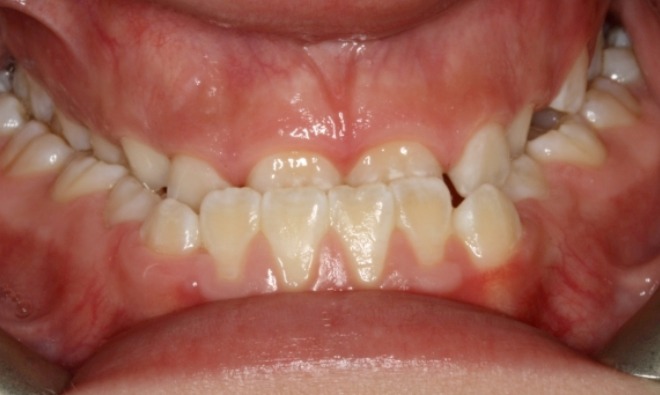 before Image