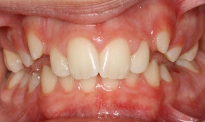 before Image
