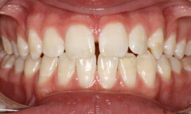 before Image