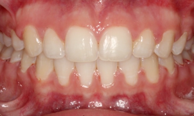 after Image