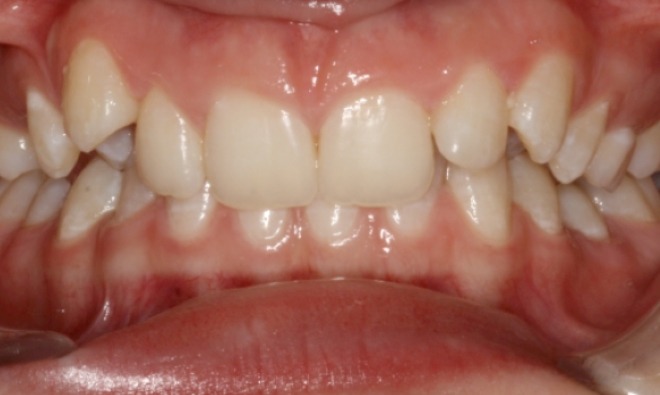 before Image