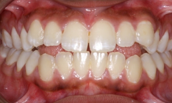 before Image