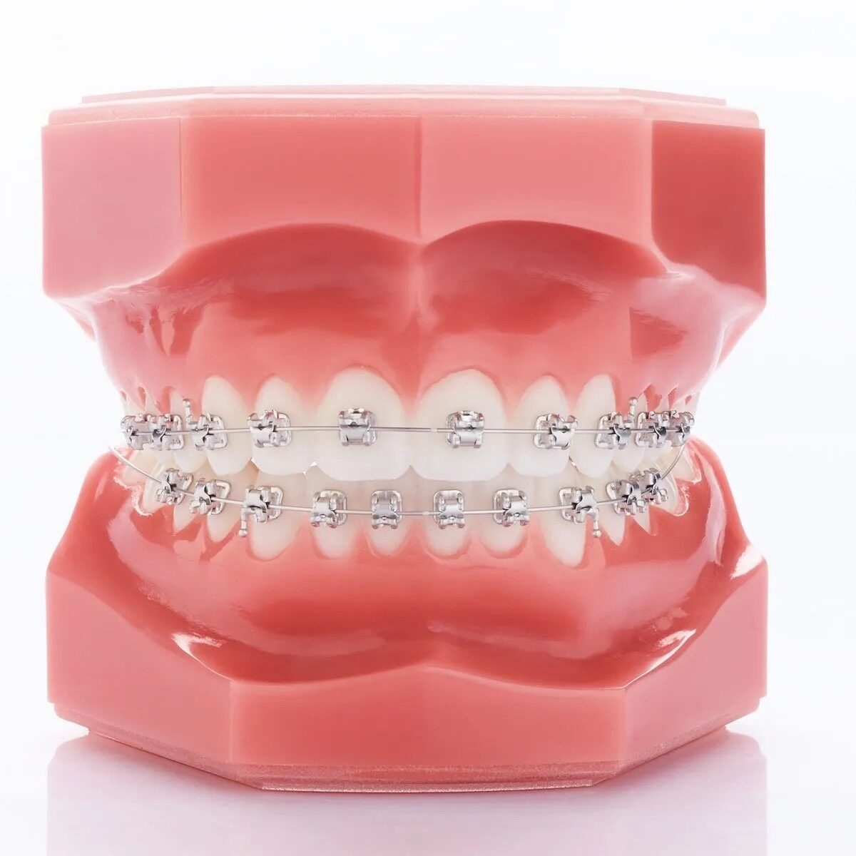 orthodontics mars